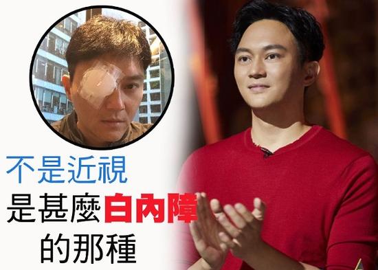 张智霖《幻乐之城》自曝患白内障 最近已经做手术